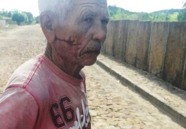 Idoso foi agredido dentro de casa