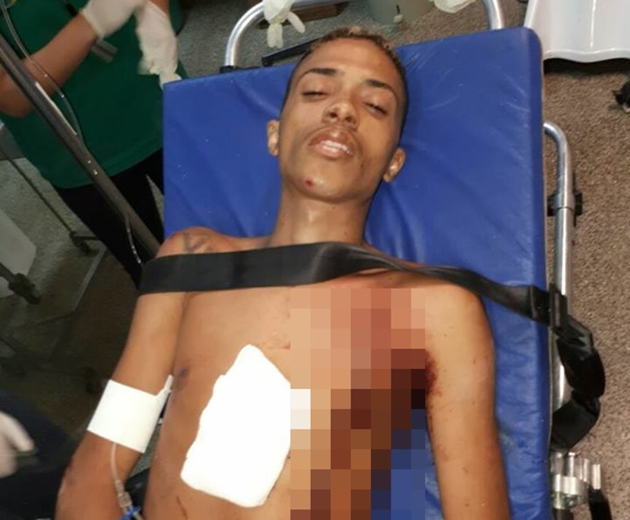 Vítima foi alvejada por dois tiros