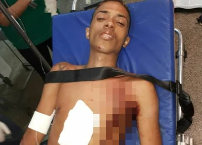 Vítima foi alvejada por dois tiros
