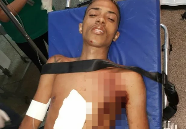 Vítima foi alvejada por dois tiros