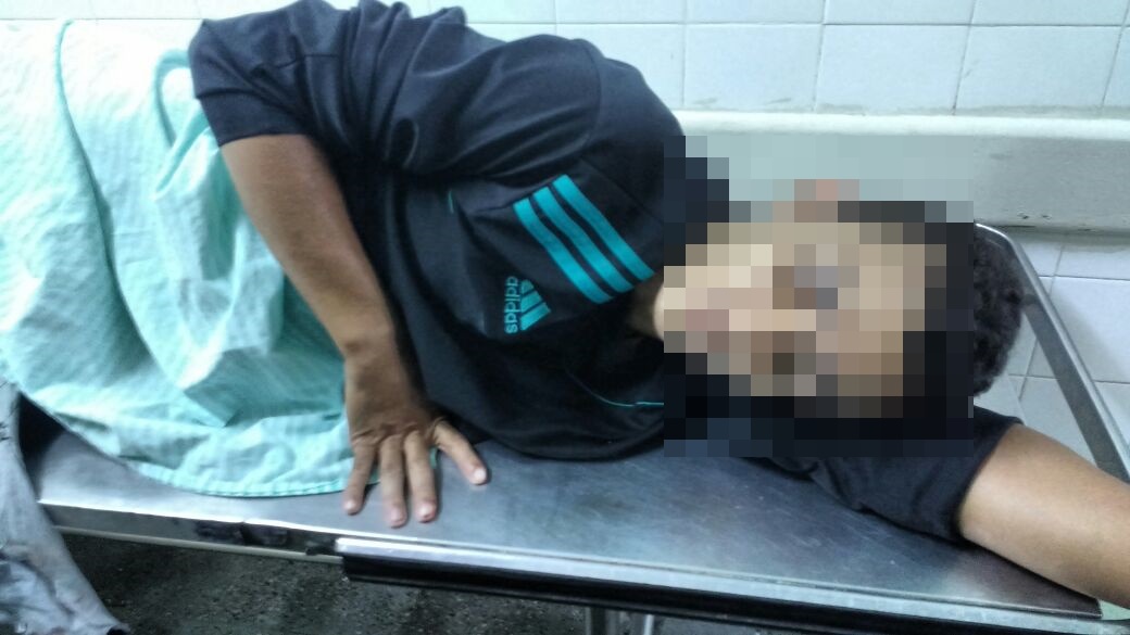 Menor baleado