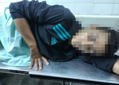 Menor baleado