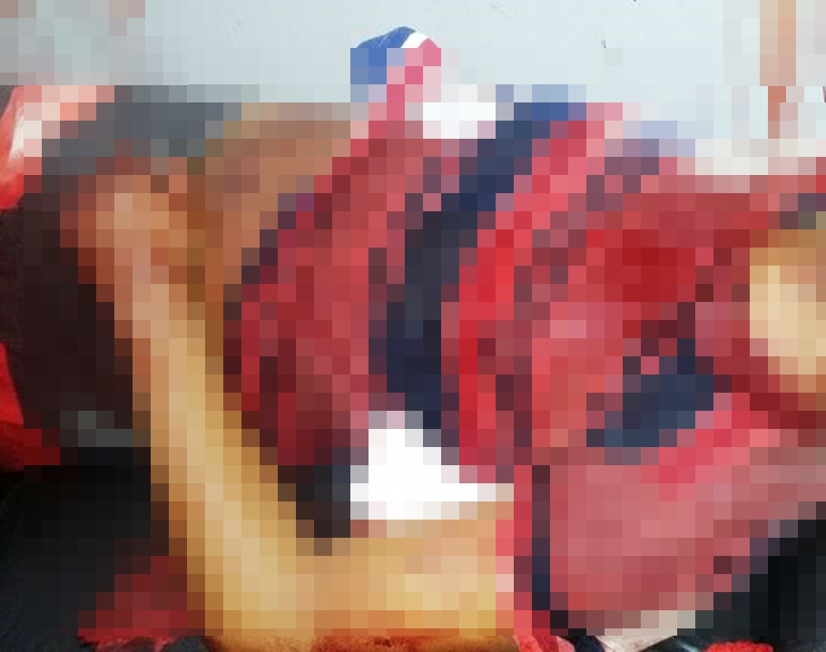 Menor foi atingido com tiro no pescoço 