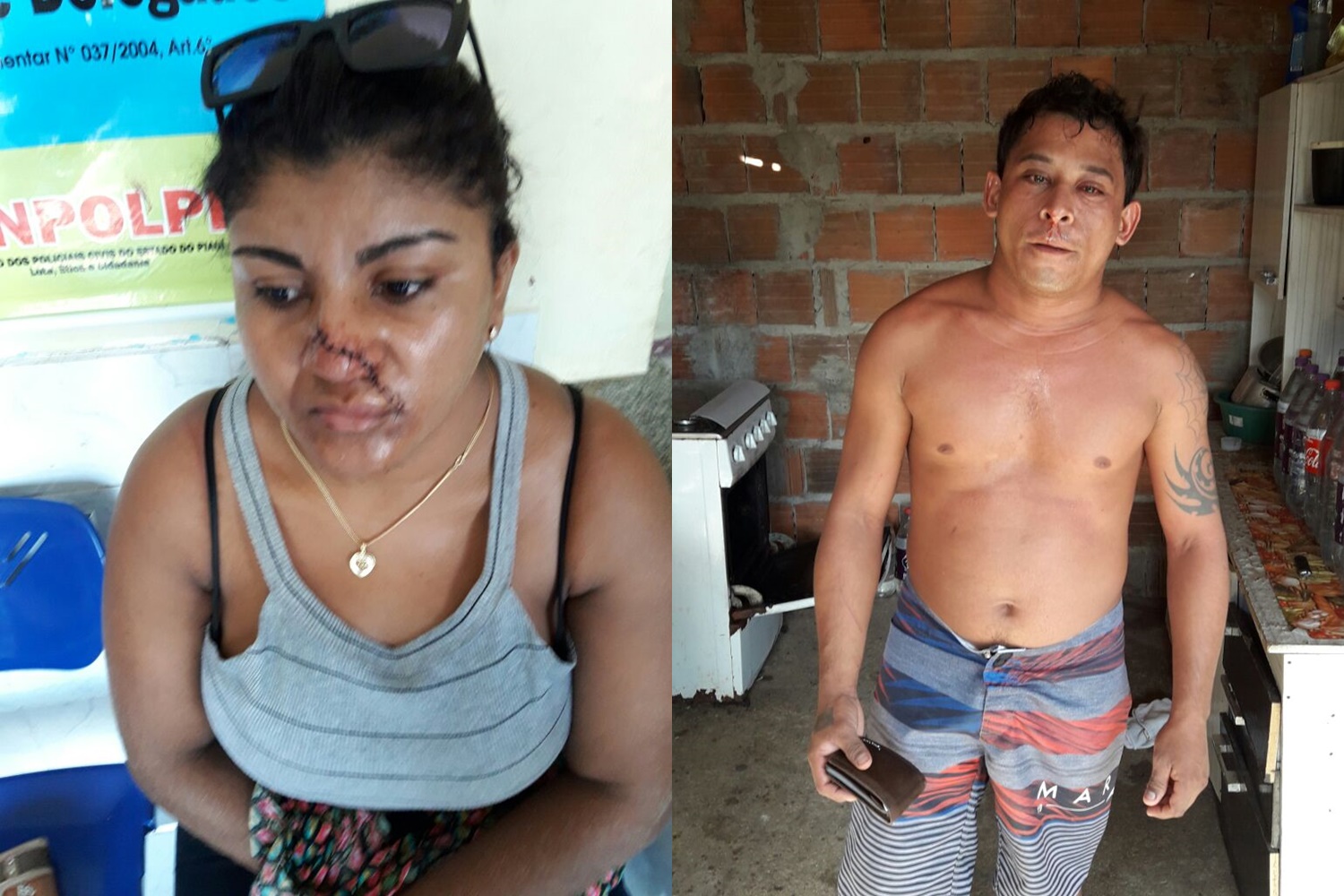 Homem esfaqueia esposa no rosto