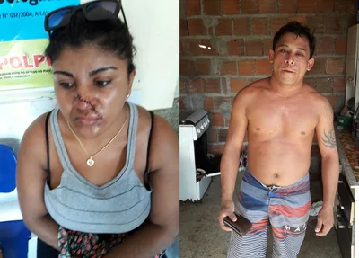 Homem esfaqueia esposa no rosto