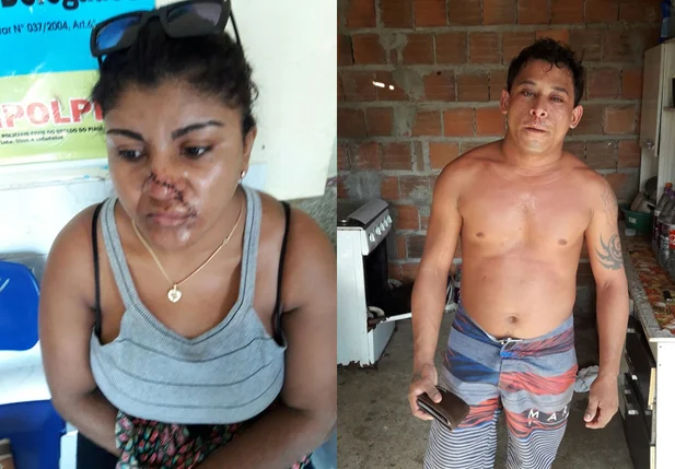 Homem esfaqueia esposa no rosto