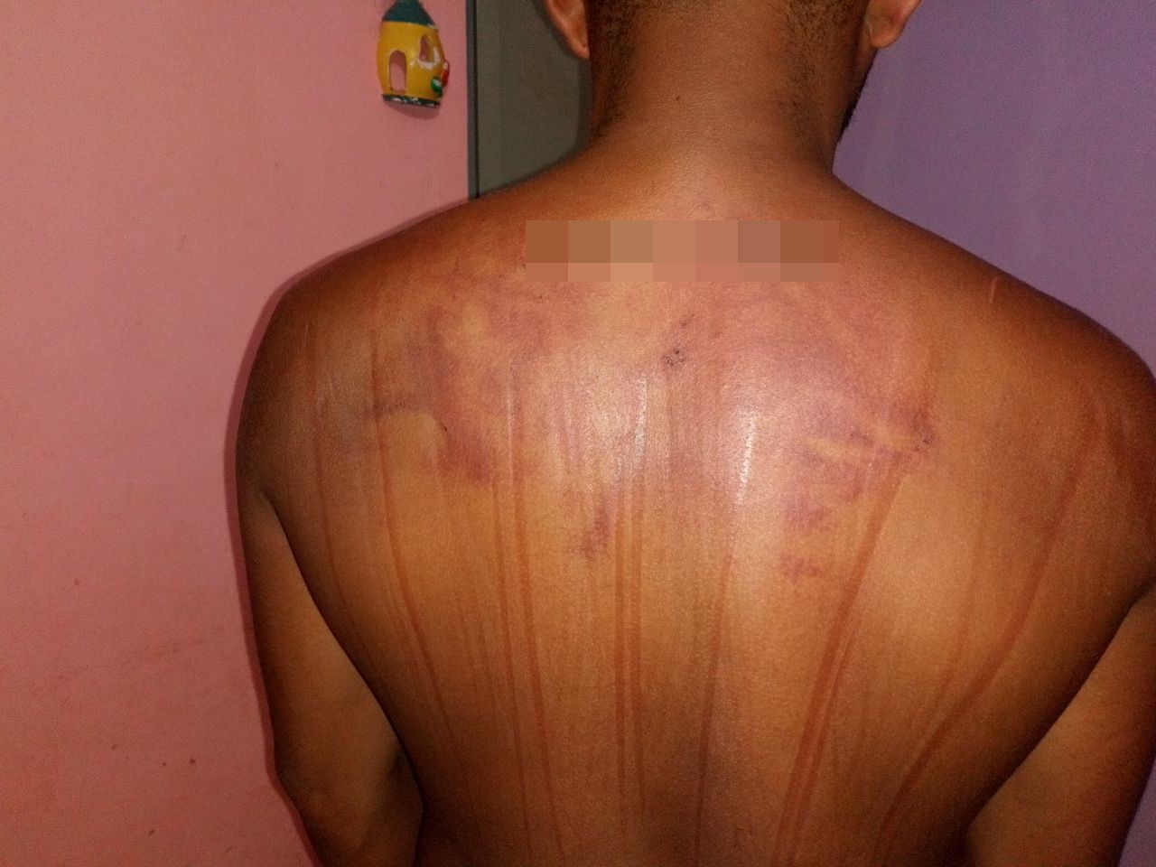 Marcas das agressões