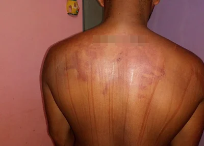 Marcas das agressões