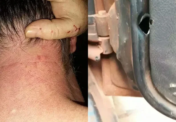 Jornalista é agredido por segurança do prefeito de Corrente