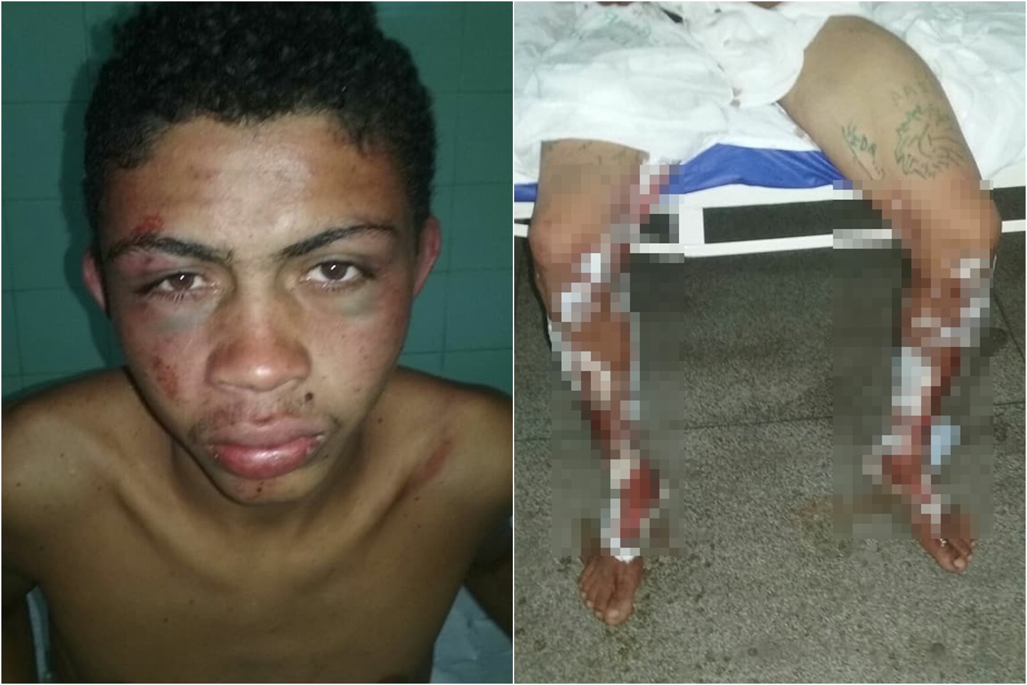 Jovem é espancado em Barro Duro