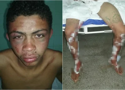 Jovem é espancado em Barro Duro