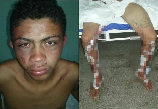Jovem é espancado em Barro Duro
