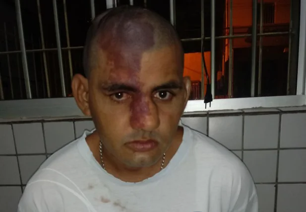 Carlos Barbosa