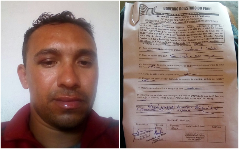 Motorista Arnoldo Pereira e o exame de corpo de delito