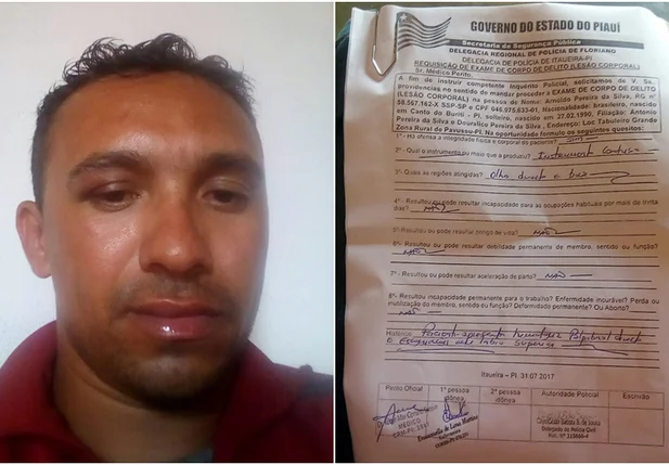 Motorista Arnoldo Pereira e o exame de corpo de delito