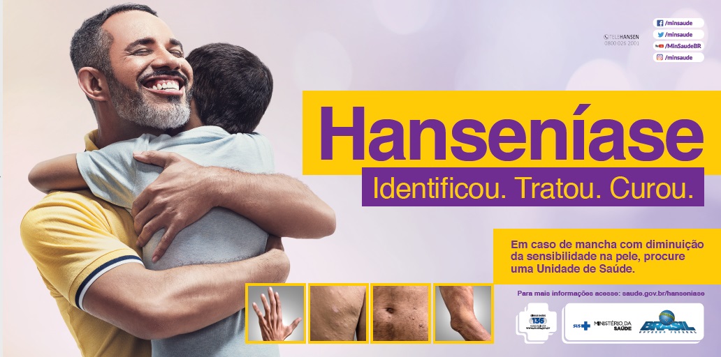 Campanha sobre a Hanseníase em Teresina