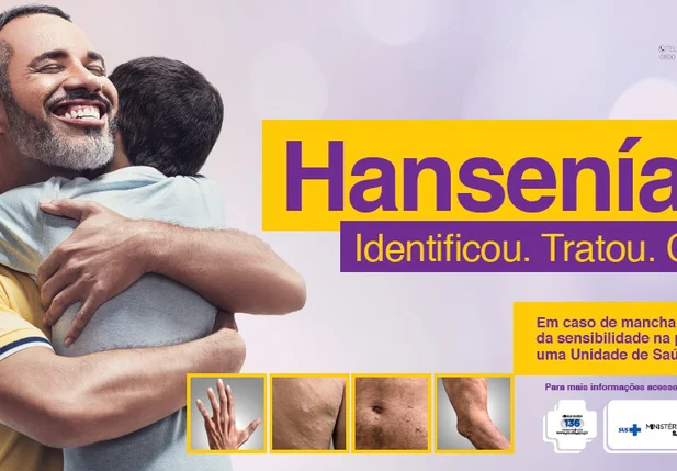 Campanha sobre a Hanseníase em Teresina