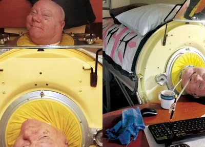 Advogado Paul Alexander viva há 64 anos preso em máquina nos EUA