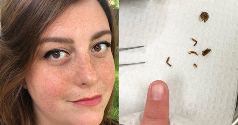 Kate Holley passou nove dias com o inseto dentro do ouvido