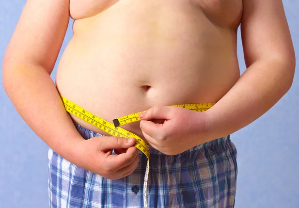 Obesidade