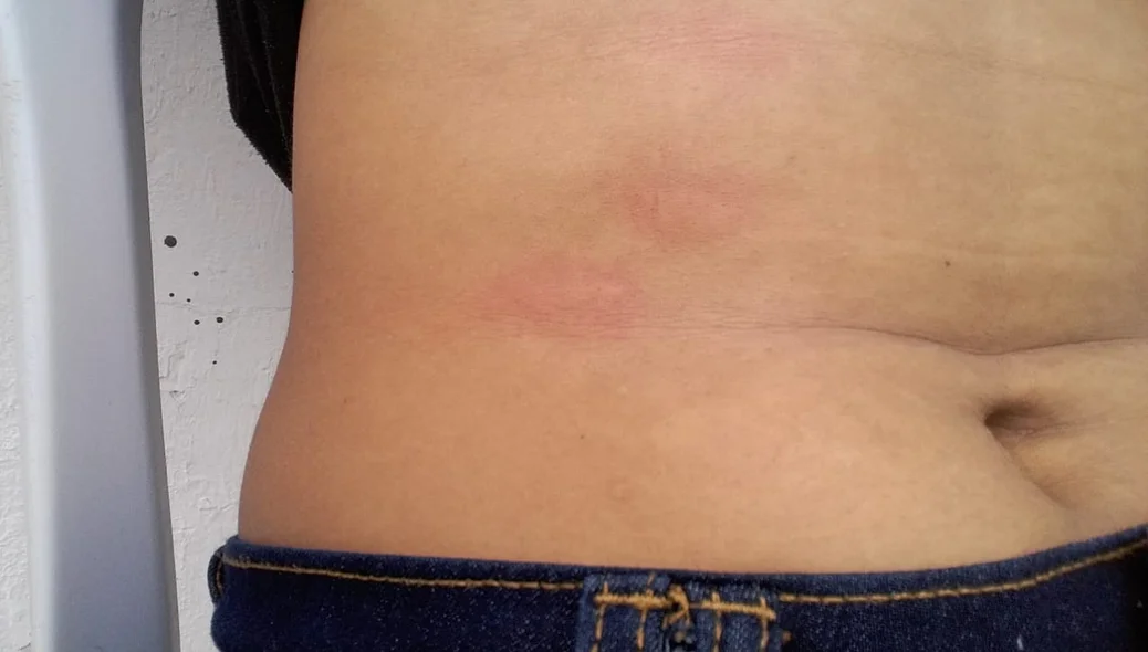 Estudante diz que foi agredida por policiais