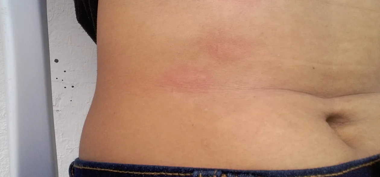 Estudante diz que foi agredida por policiais