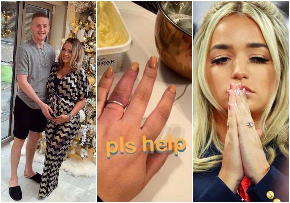 Megan estava com os dedos inchados devido a gravidez