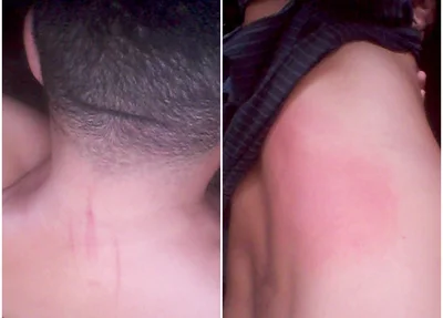 Agressões sofridas pela vítima