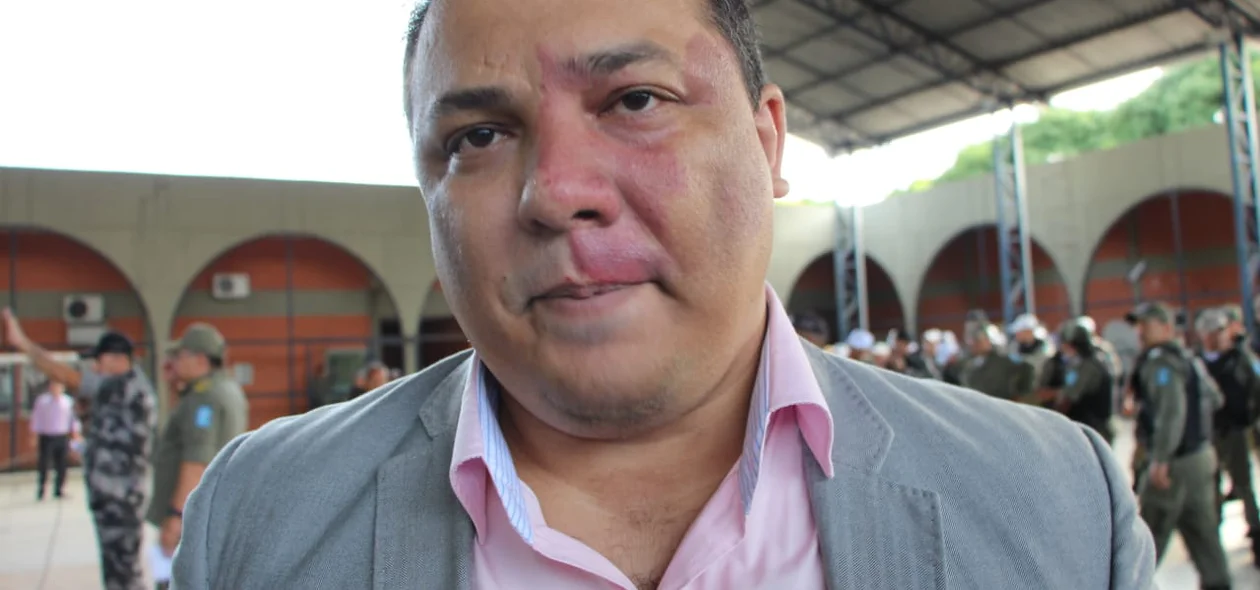 Delegado Luccy Keiko
