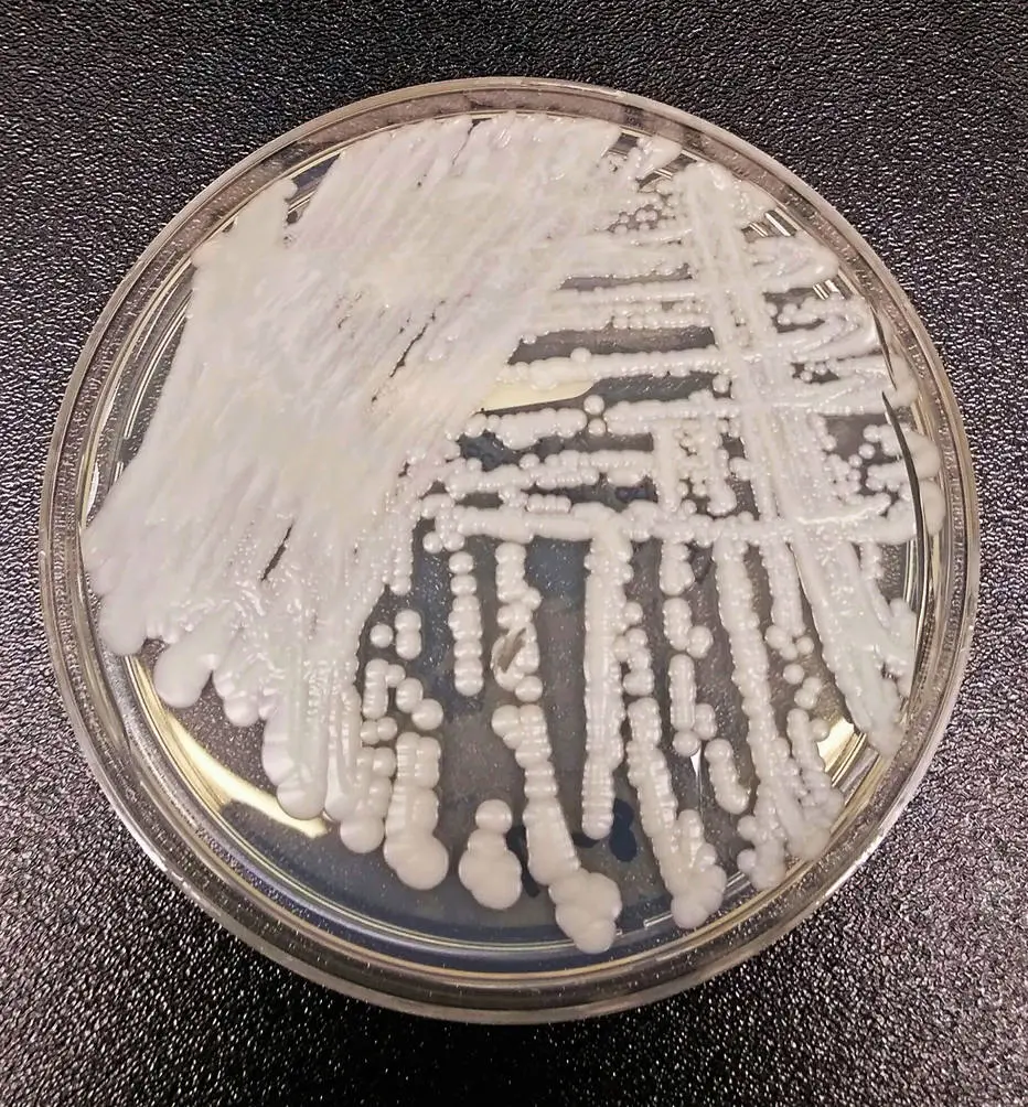 Fungo Candida auris