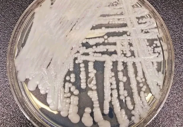 Fungo Candida auris