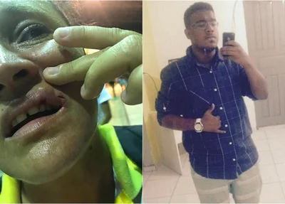 Eliete Fontenele foi agredida por Rodrigo Quixada