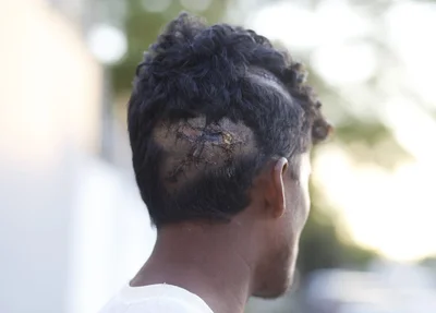 Erisnaldo foi atacado com golpes de foice