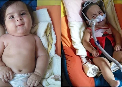 Kemily foi diagnosticada com AME Tipo 1