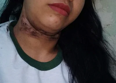 Tatiana teve um corte profundo no pescoço