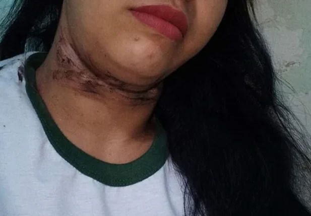Tatiana teve um corte profundo no pescoço