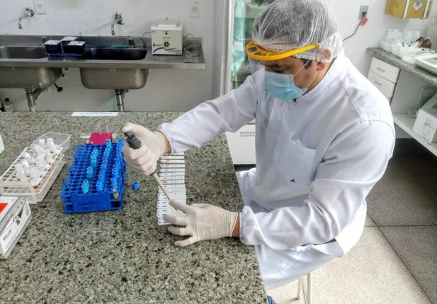 Laboratório do HGV já realizou mais de mil exames para covid-19