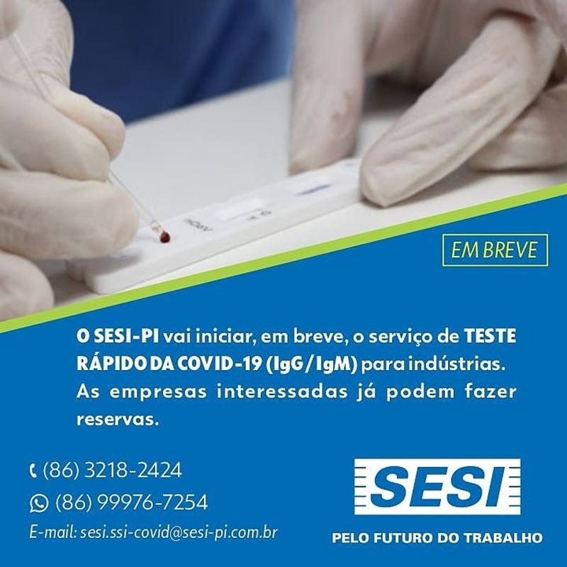 SESI vai oferecer serviço de teste rápido da covid-19