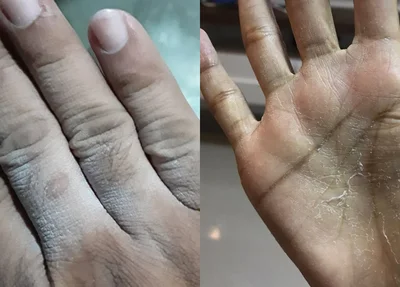 Mãos de moradores que utilizam a água do condomínio