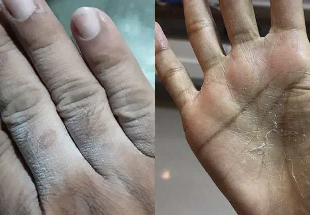 Mãos de moradores que utilizam a água do condomínio
