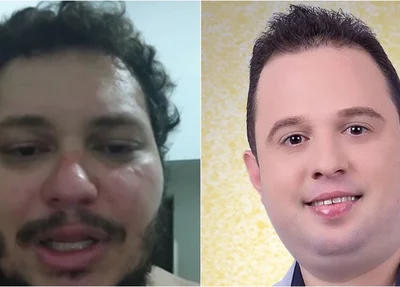 Prefeito Erivelto Barros é acusado de agredir professor em bar