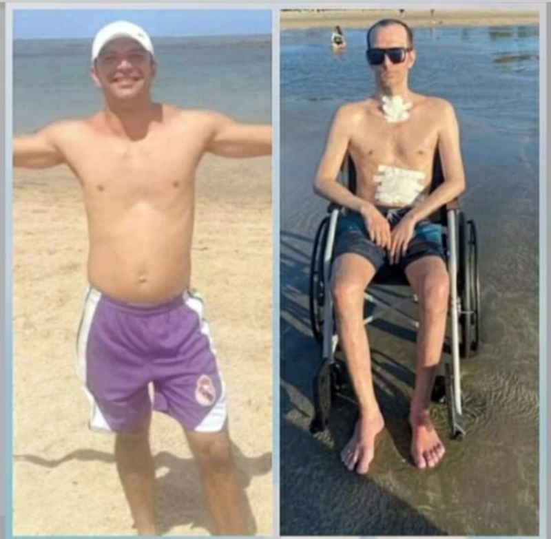 Herbert Sarmento ficou tetraplégico