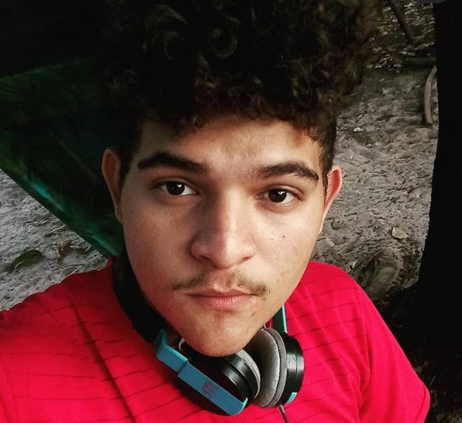 Breno, vítima de sofrer queimaduras pela sogra