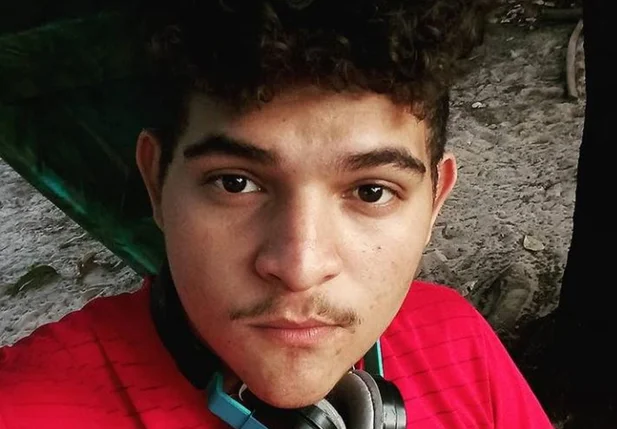 Breno, vítima de sofrer queimaduras pela sogra