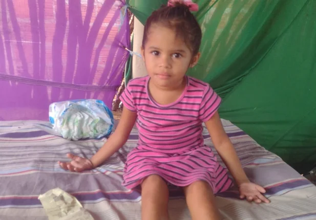 Família de criança que teve corpo queimado no Piauí pede ajuda