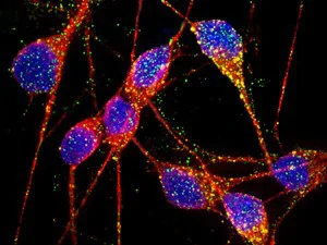 Neurônios afetados pela doença de Alzheimer 