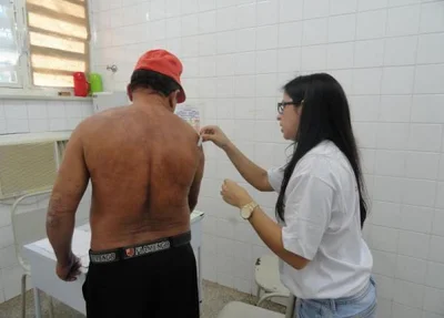Teste de Hanseníase