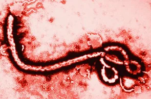 Vírus causador do Ebola