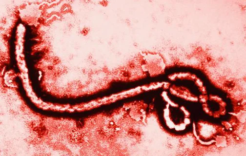 Vírus causador do Ebola