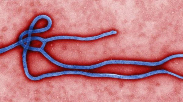 Vírus Ebola, causador de uma febre hemorrágica que mata at